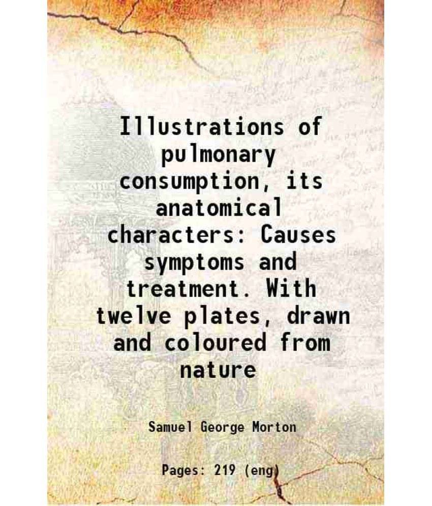 Illustrations Of Pulmonary Consumption, Its Anatomical Characters Causes Symptoms And Treatment. With Twelve Plates, Drawn An-.. Illustrations Of Pulmonary Consumption, Its Anatomical Characters Causes Symptoms And Treatment. With Twelve Plates, Drawn An-..
