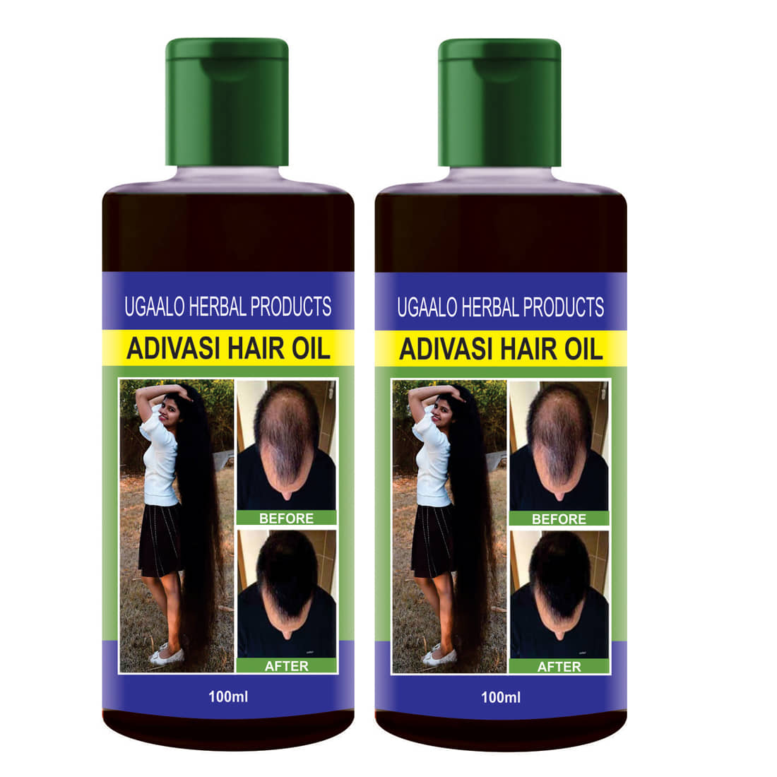 Ugaalo - Hair Growth Others 200 ml ( Pack of 2 )