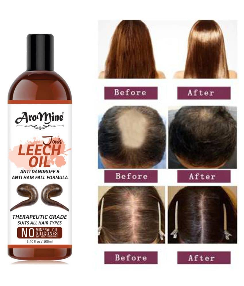 Aromine Natural Jonk Leech Oil For Hair Growth & Dandruff Oil- 100 mL