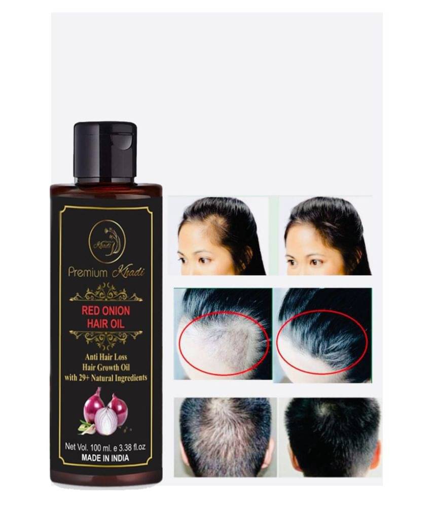 Premium Khadi RED ONION OIL For Anti Hair Fall & Hair Growth 100 mL Premium Khadi RED ONION OIL For Anti Hair Fall & Hair Growth 100 mL