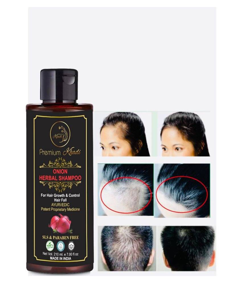 Premium Khadi Onion Shampoo For Hair Growth With Aloevera, Argan oil SLS & Paraben Free Shampoo 210 mL Premium Khadi Onion Shampoo For Hair Growth With Aloevera, Argan oil SLS & Paraben Free Shampoo 210 mL