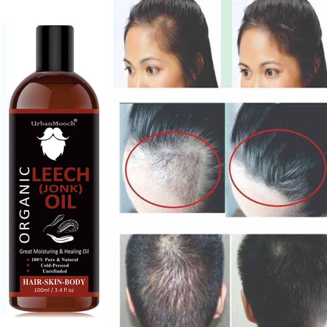 UrbanMooch Natural Jonk Leech Oil For Hair Growth & Dandruff Oil- 100 mL