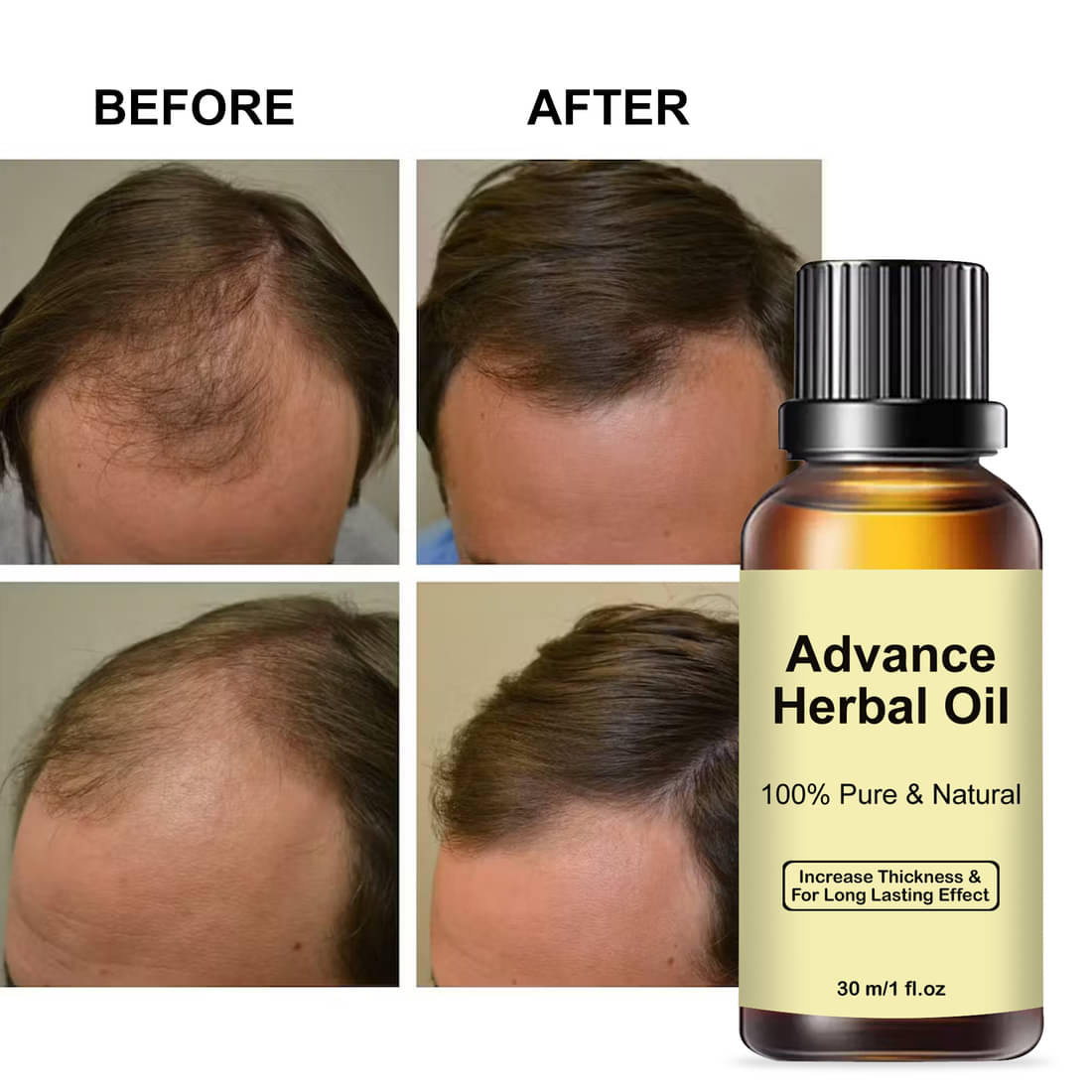 Treszo Anti Hair Fall Coconut Oil 30 ml ( Pack of 1 ) Treszo Anti Hair Fall Coconut Oil 30 ml ( Pack of 1 )