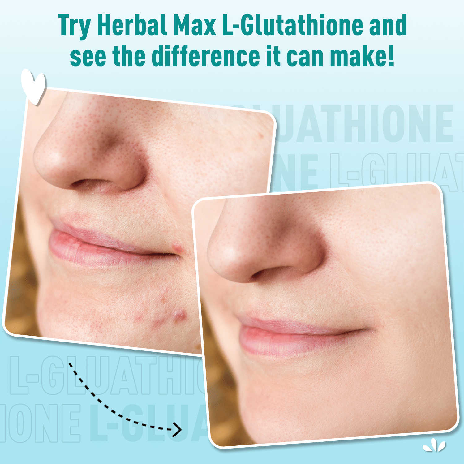 Herbal Max L-Glutathione Tablets for Glowing Skin and Reduced Pigmentation  - Skin Whitening and Care Kit with Vitamin C, Biotin, and Moisturizer -  Anti-Ageing, Dark Spot and Pimple Remover