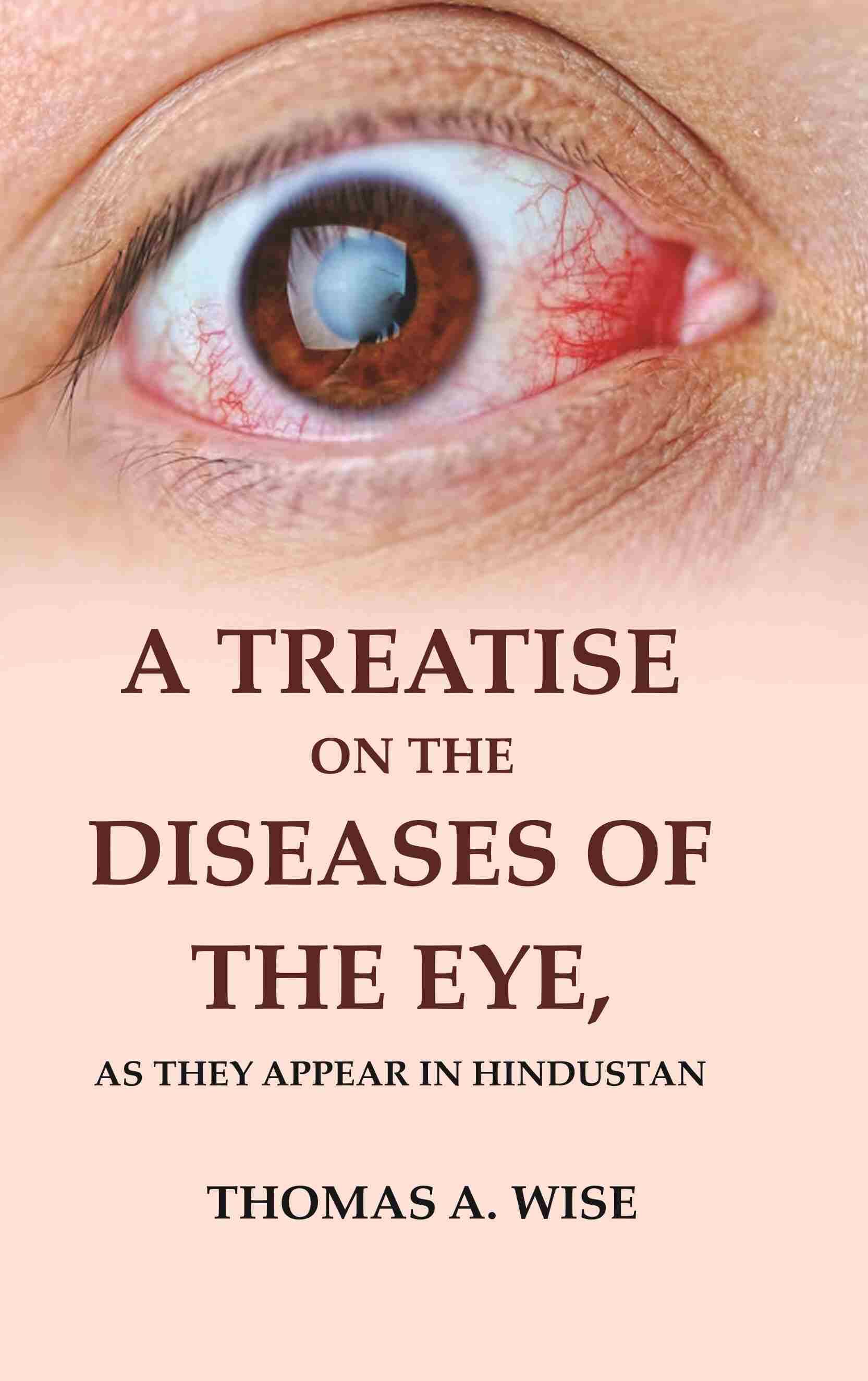     			A Treatise on the Diseases of The Eye: As they Appear in Hindustan [Hardcover]