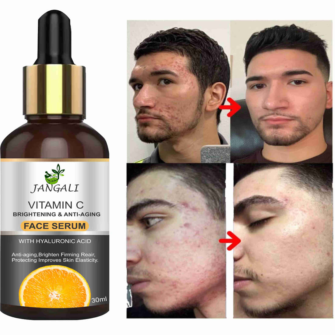 Pure Jangali Organics Face Serum Vitamin C Moisturizing For All Skin Type ( Pack of 1 )