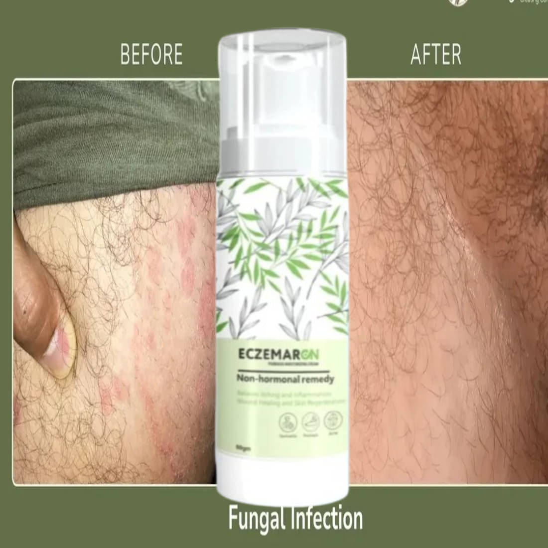     			Elatiz Moisturizer All Skin Type Aloe Vera ( 50 gm )