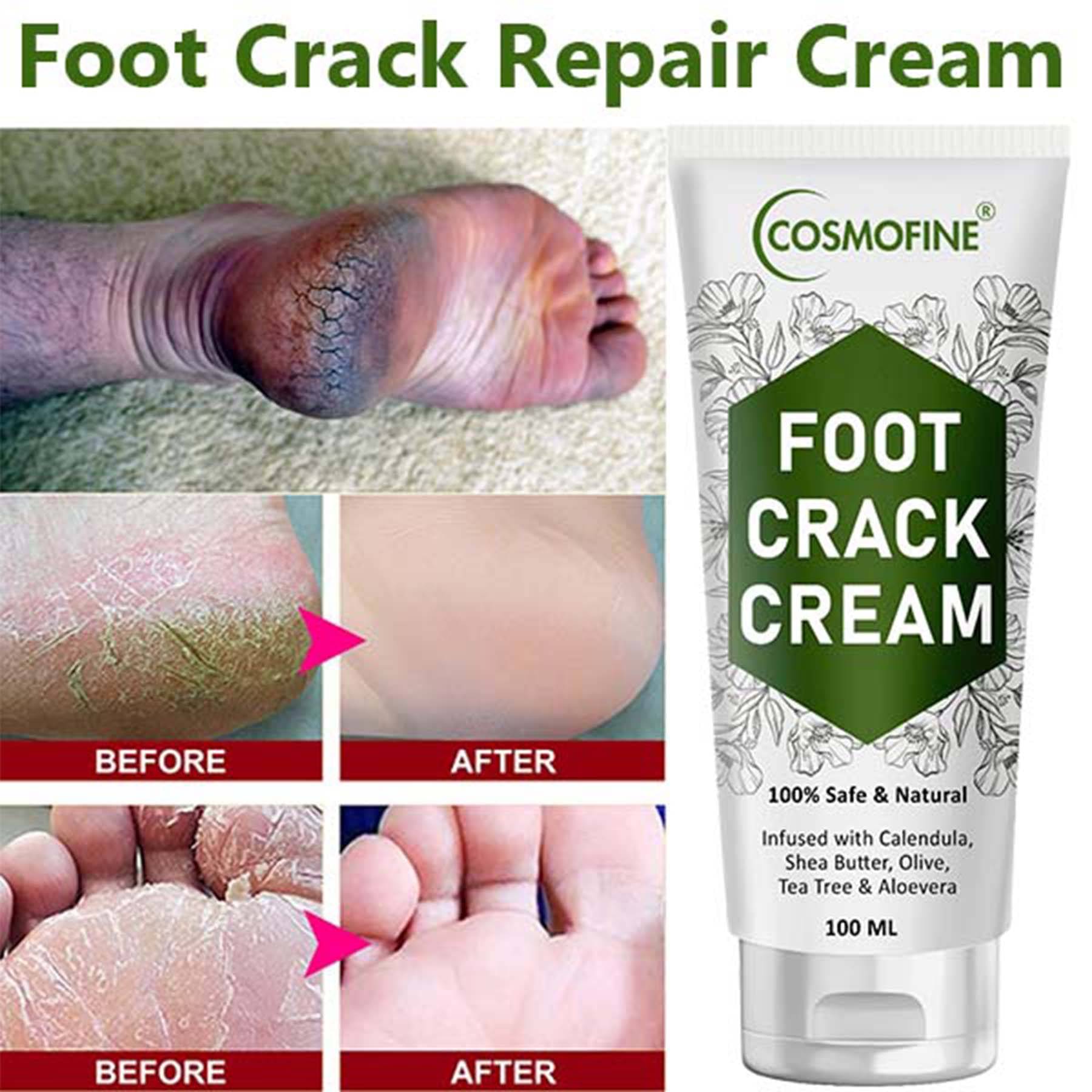     			COSMOFINE Cracked Skin Repair Cream, Crack Heal Cream, Foot Crack Cream for All year (100 mL)
