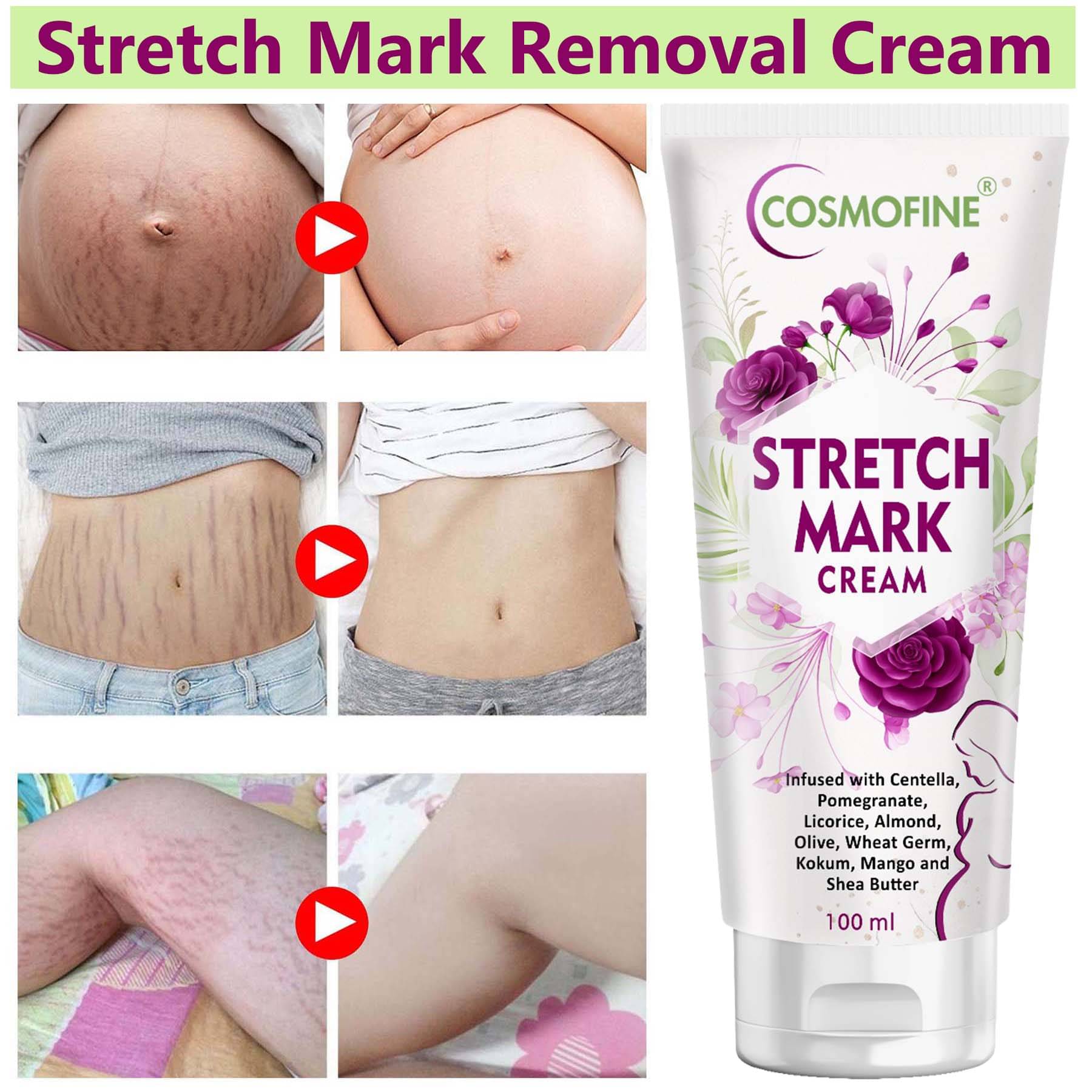     			COSMOFINE Skin Tightening Cream, Stretch Mark Removal Cream, Scar Removal Cream (100 g)