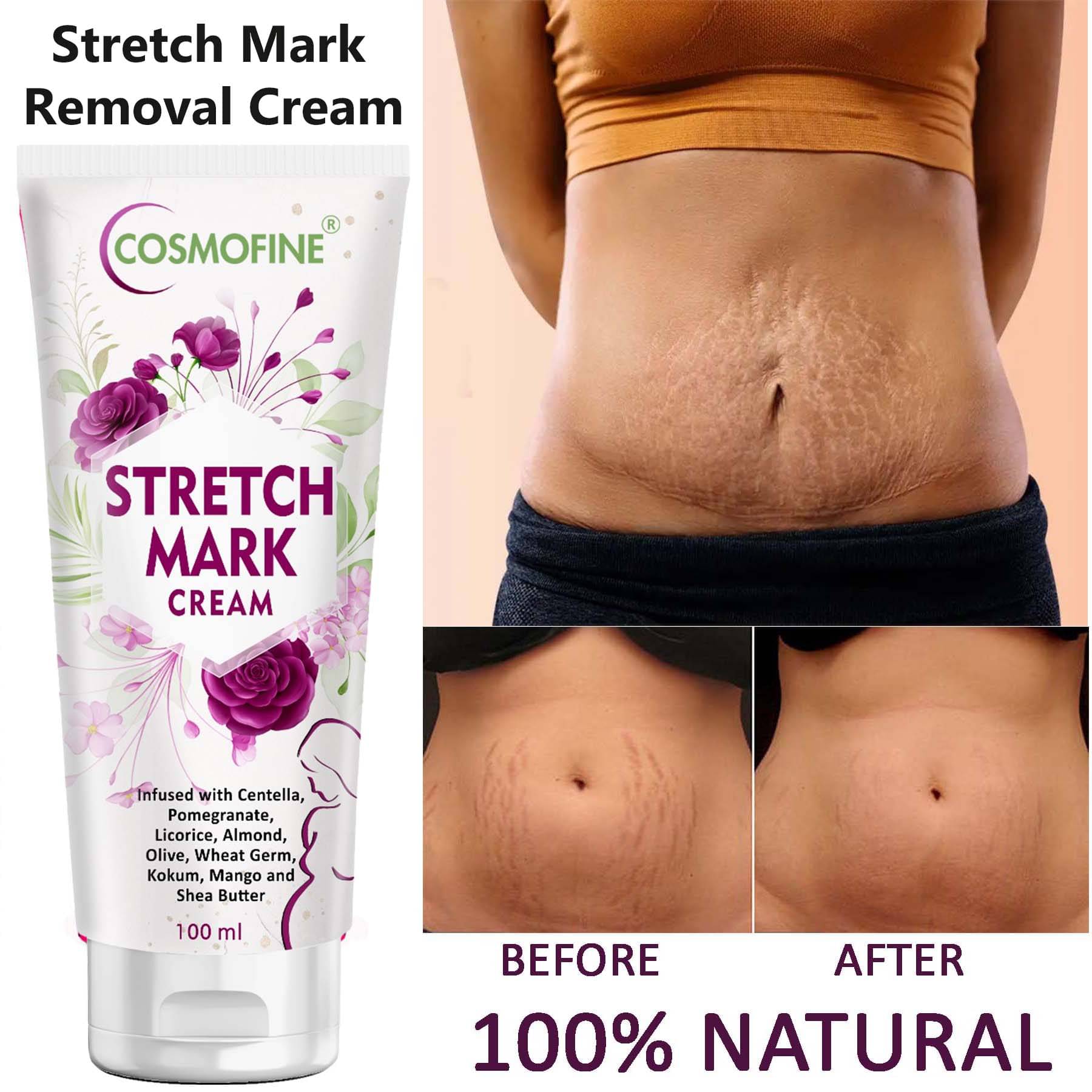COSMOFINE Skin Tightening Cream Stretch Mark Removal Cream, Shaping & Firming Cream (100 g) COSMOFINE Skin Tightening Cream Stretch Mark Removal Cream, Shaping & Firming Cream (100 g)