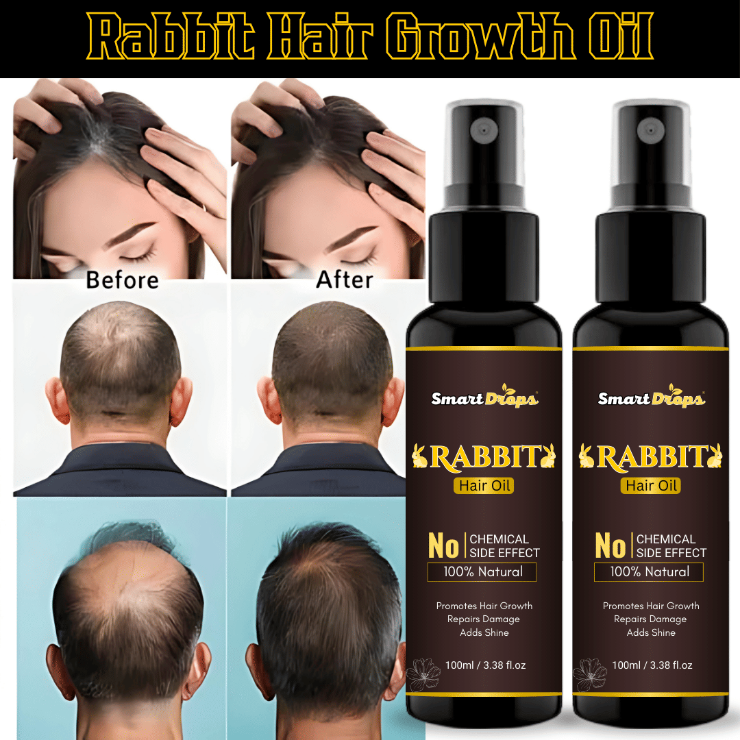     			Smartdrops Anti Dandruff Argan Oil 200 ml ( Pack of 2 )