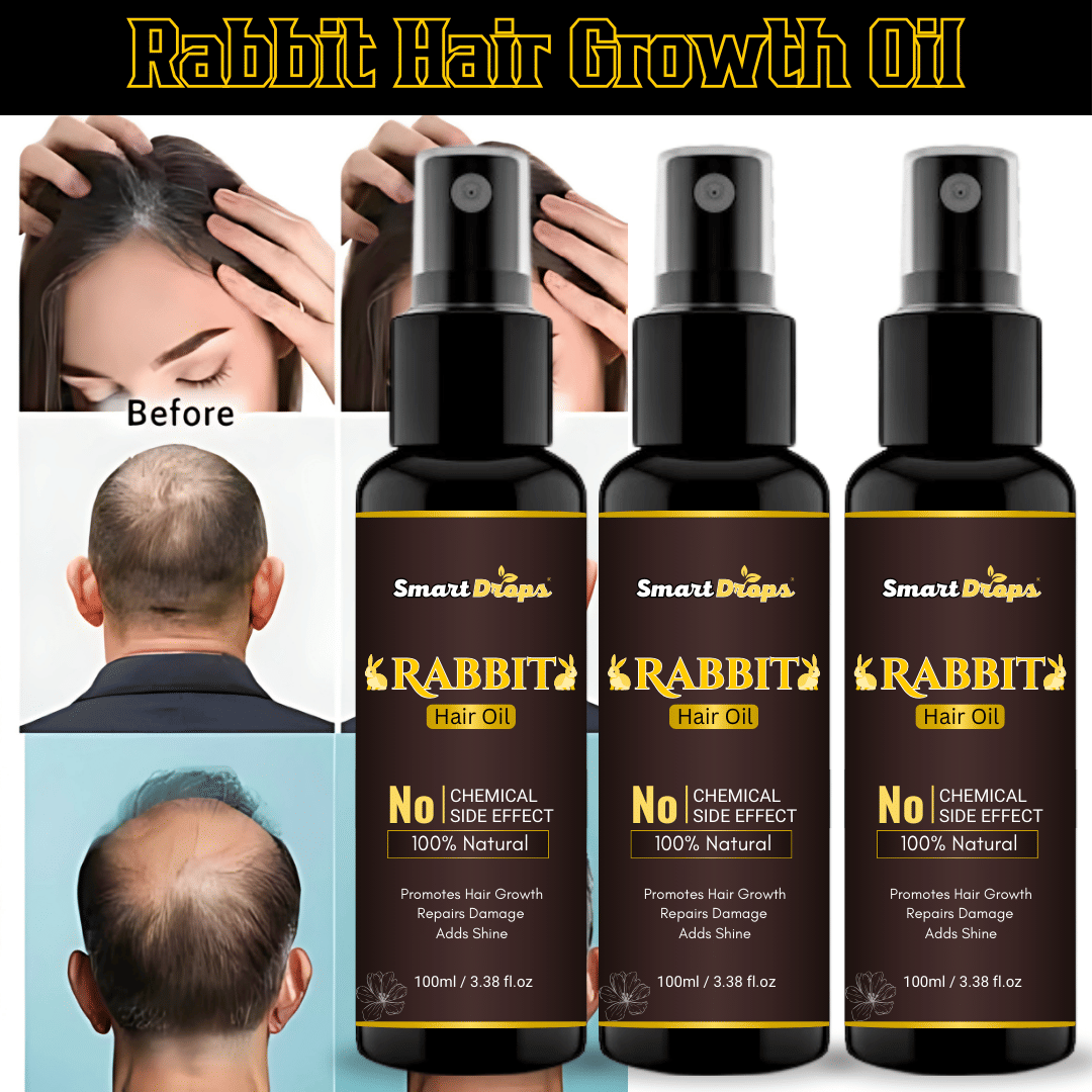 Smartdrops Anti Dandruff Coconut Oil 300 ml ( Pack of 3 )