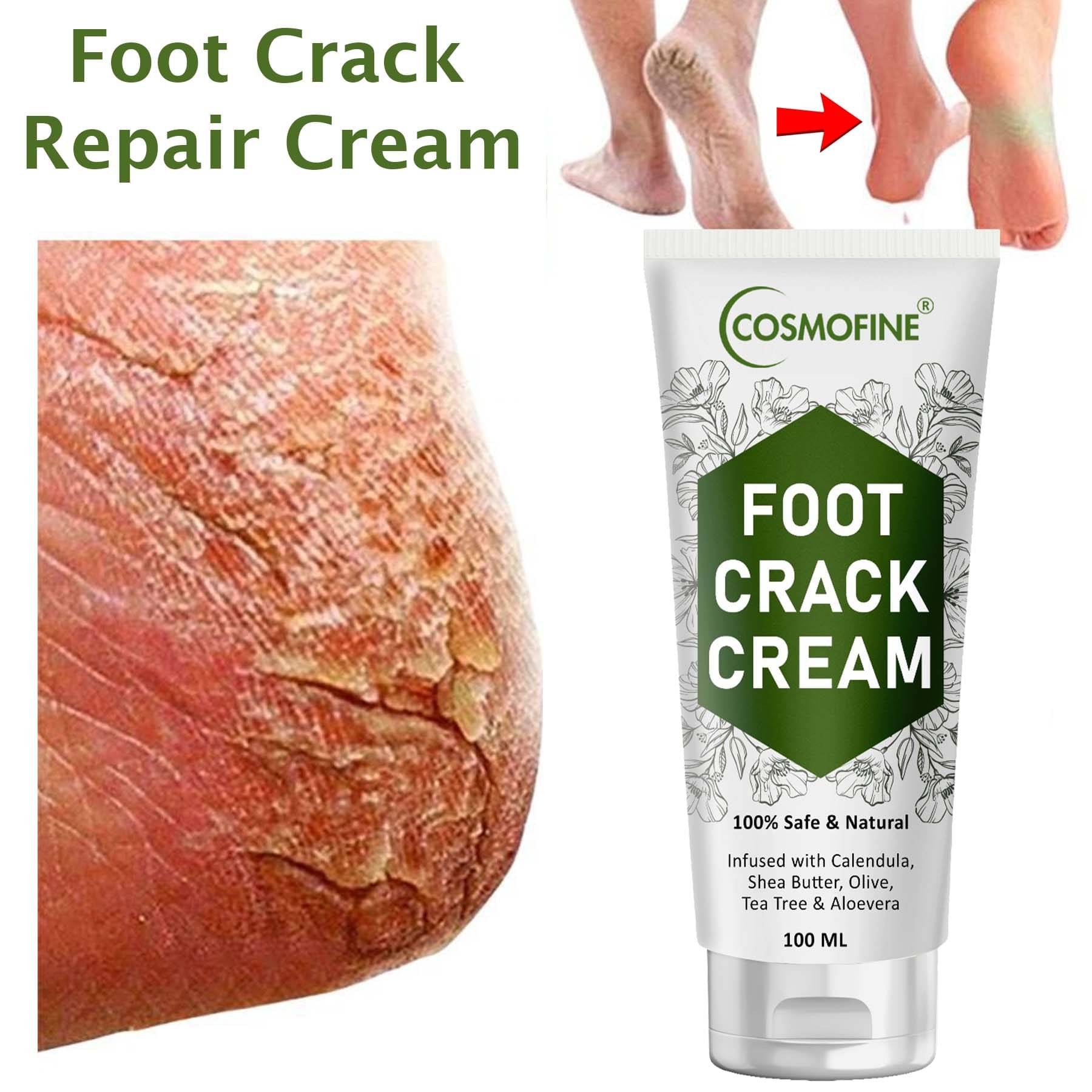     			COSMOFINE Skin Repair Cream, Foot Crack Cream, Heel Crack Cream for All year (100 mL)