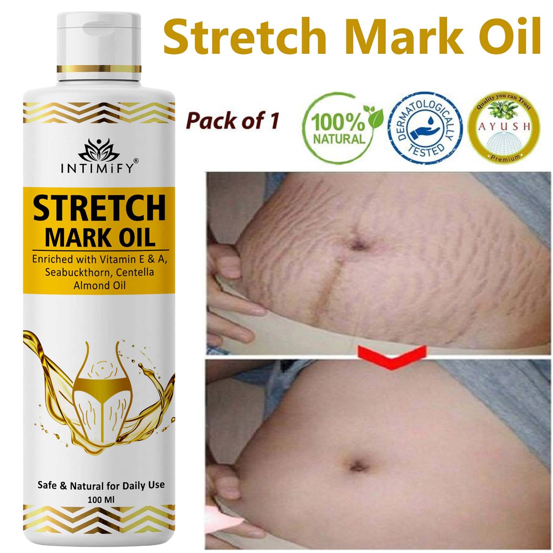     			Intimify Stretch Mark Oil, Anti Cellulite Oil, Body Shaping & Firming Oil (100 mL)