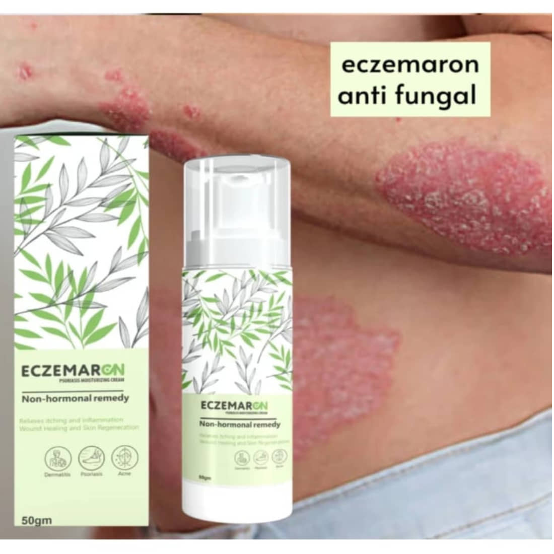 Elatiz Moisturizer All Skin Type Aloe Vera ( 50 gm )