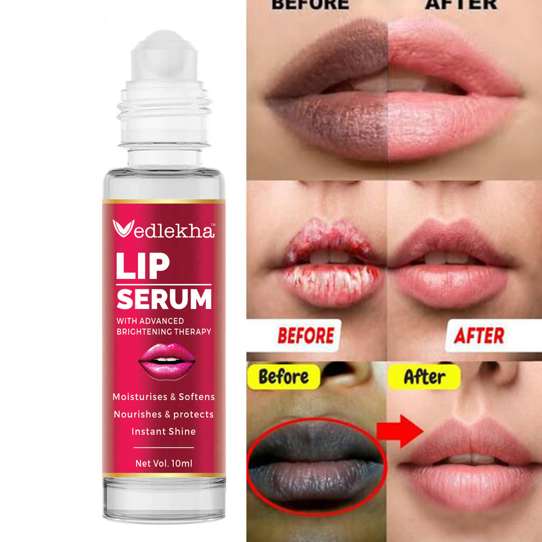 Vedlekha Face Serum Niacinamide Daily Care For All Skin Type ( Pack of 1 ) Vedlekha Face Serum Niacinamide Daily Care For All Skin Type ( Pack of 1 )