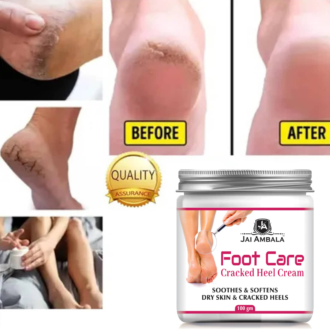 JAIAMBALA Cracked skin repair Cream for ( 100 g )