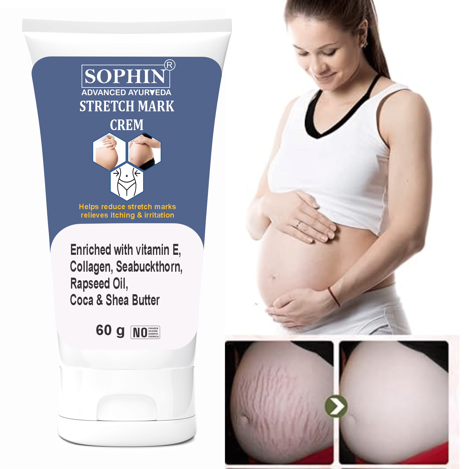 SOPHIN Black & White Head Removal Cream ( 60 g )
