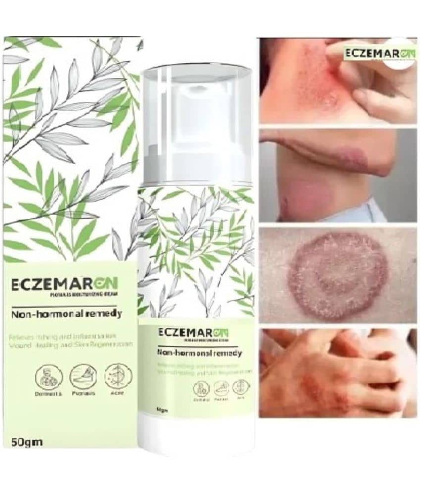Treszo Eczemaron Anti Fungal Cream for Rapid Healing for Skin ,50 g (Pack of 1)