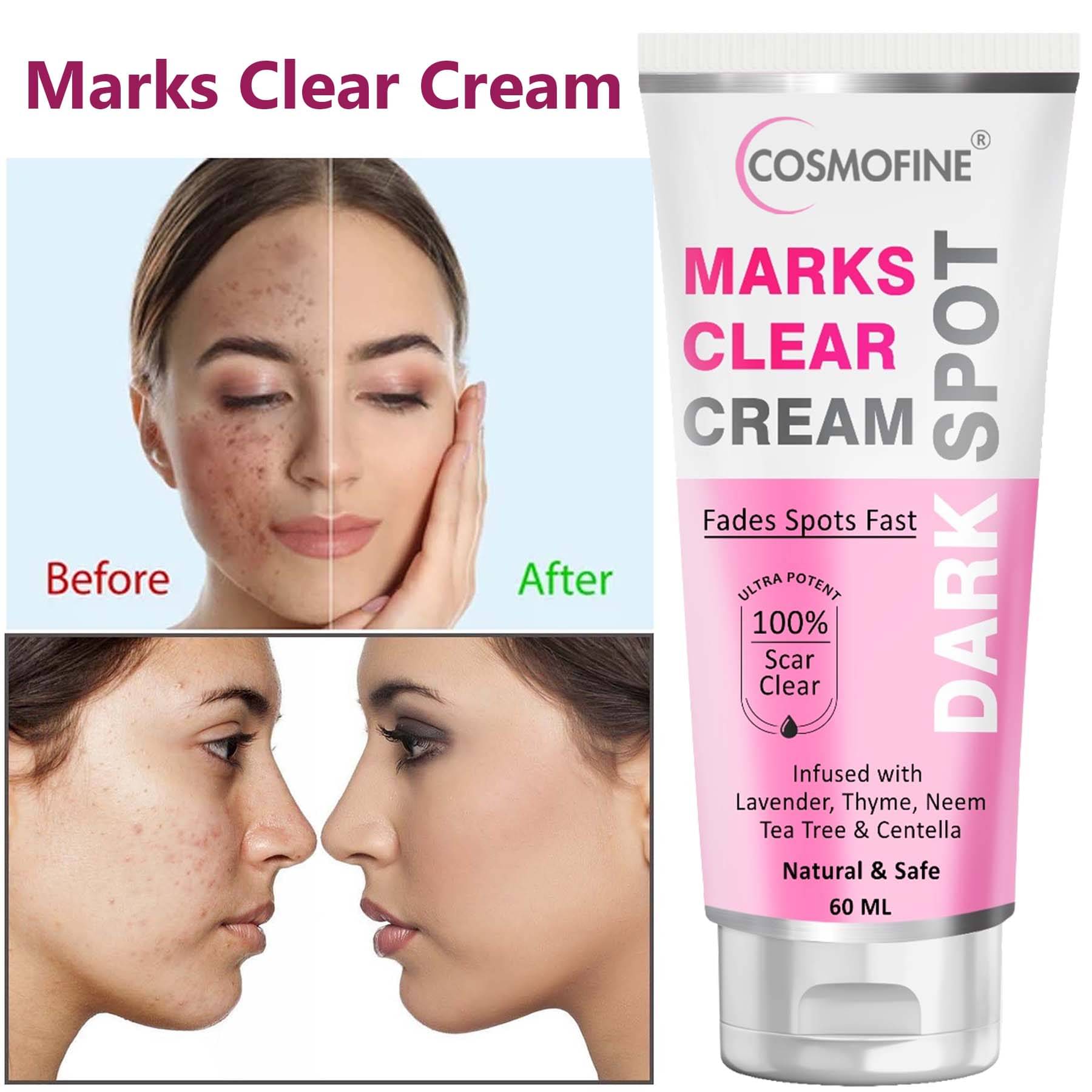     			COSMOFINE Marks Clear Cream, Pigmentation Removal Anti acne Day Cream All Skin Type Neem (60 ml)