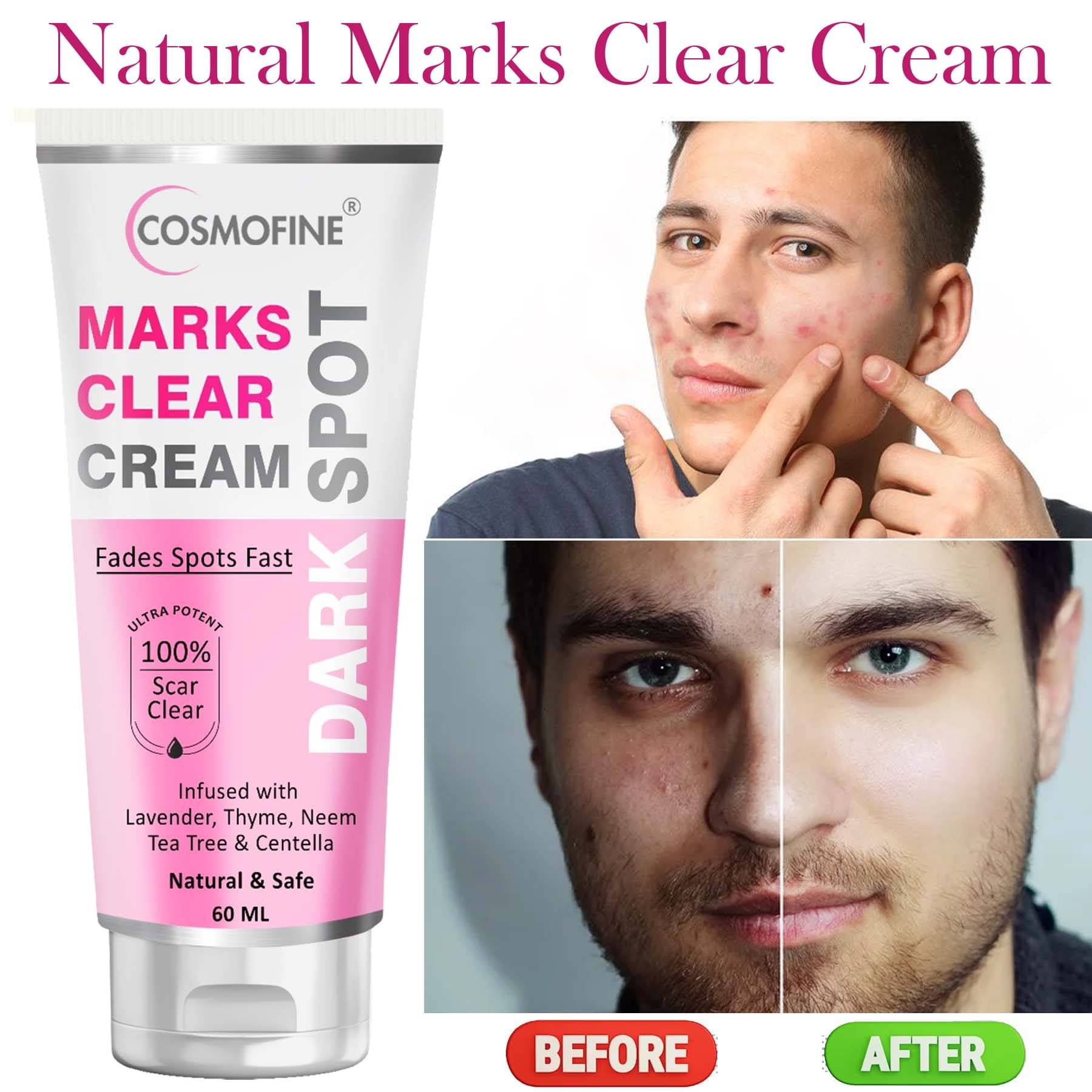     			COSMOFINE Marks Clear Cream, Pigmentation Removal Day Cream All Skin Type Neem (60 ml)