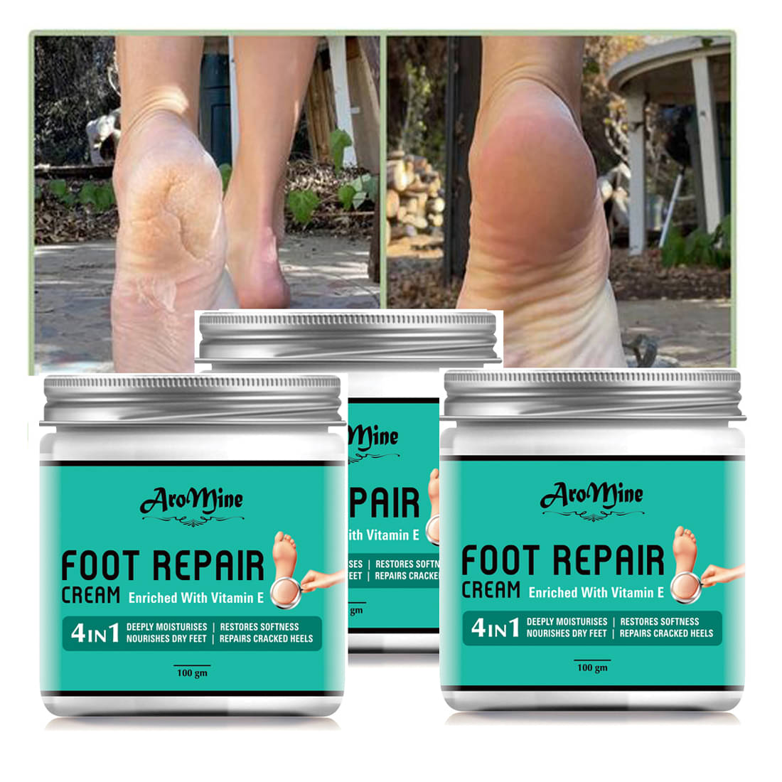 Aromine Cracked skin repair Cream for All year ( 300 g ) Pack of 3 Aromine Cracked skin repair Cream for All year ( 300 g ) Pack of 3