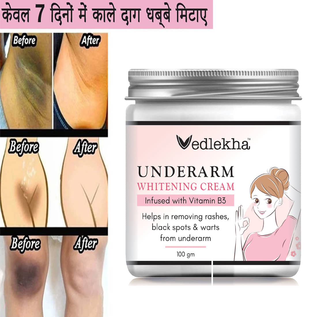 Vedlekha Moisturizer All Skin Type Vitamin C ( 100 gm )
