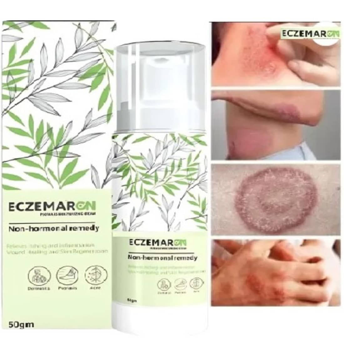 Vedlekha Moisturizer All Skin Type Tea Tree ( 100 gm )