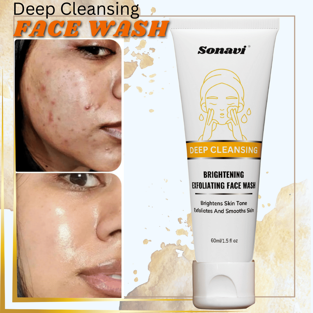 Sonavi - Acne or Blemishes Removal Face Wash For All Skin Type ( Pack of 1 )