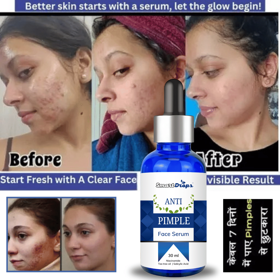 Smartdrops Face Serum Glycolic Acid Daily Care For Combination Skin ( Pack of 1 ) Smartdrops Face Serum Glycolic Acid Daily Care For Combination Skin ( Pack of 1 )