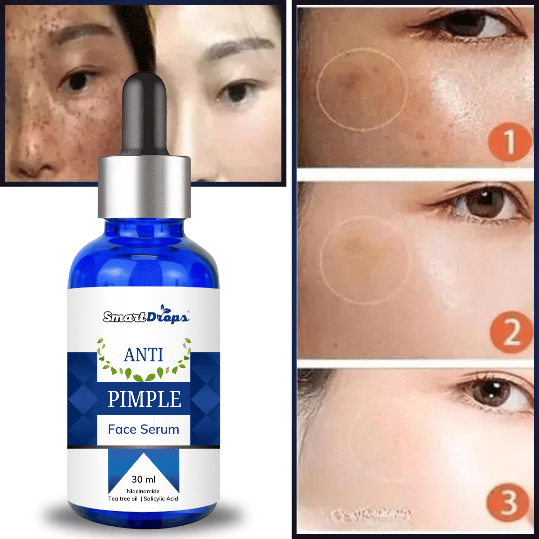 Smartdrops Face Serum Glycolic Acid Radiant Glow For Oily Skin ( Pack of 1 ) Smartdrops Face Serum Glycolic Acid Radiant Glow For Oily Skin ( Pack of 1 )