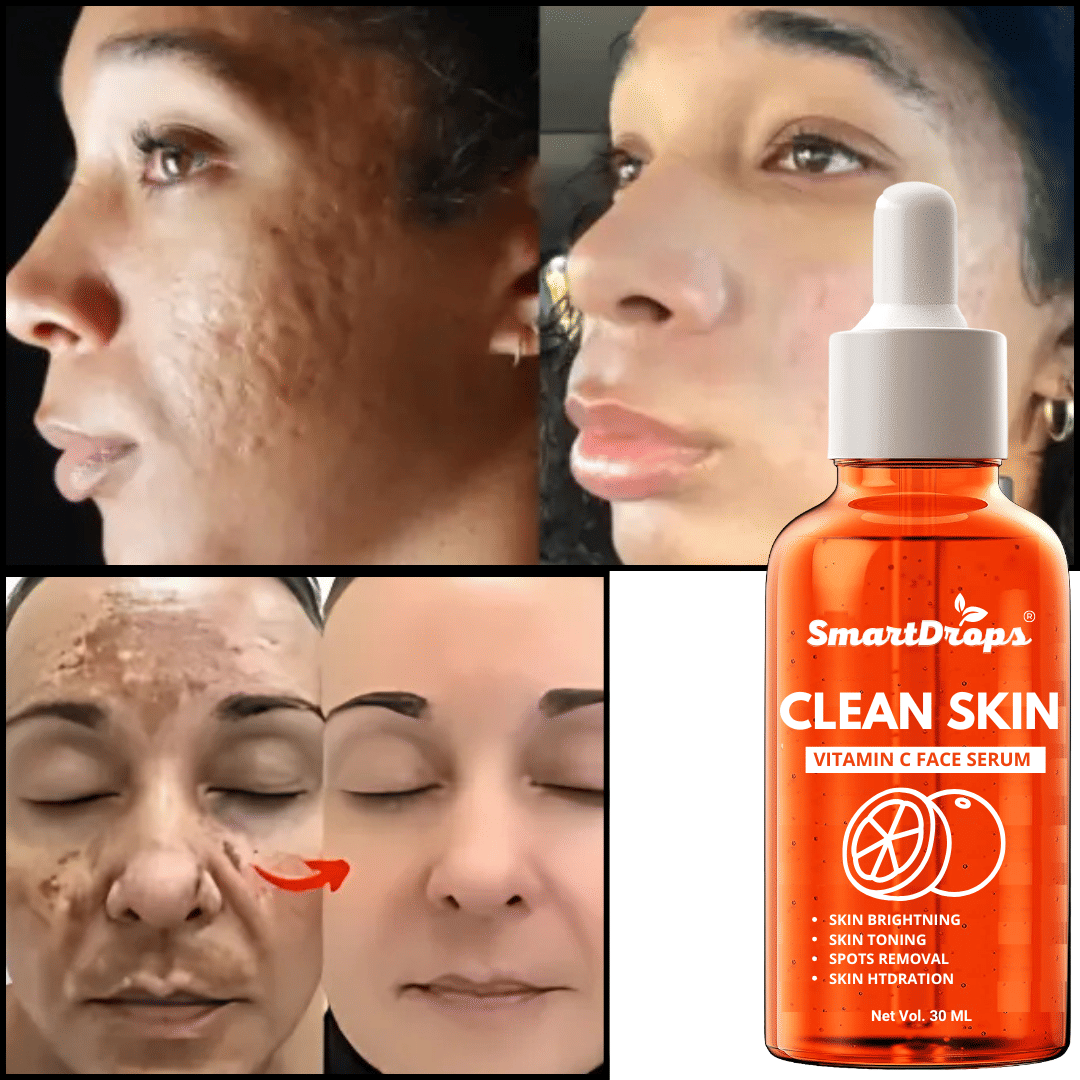 Smartdrops Face Serum Glycolic Acid Skin Toning For Sensitive Skin ( Pack of 1 )