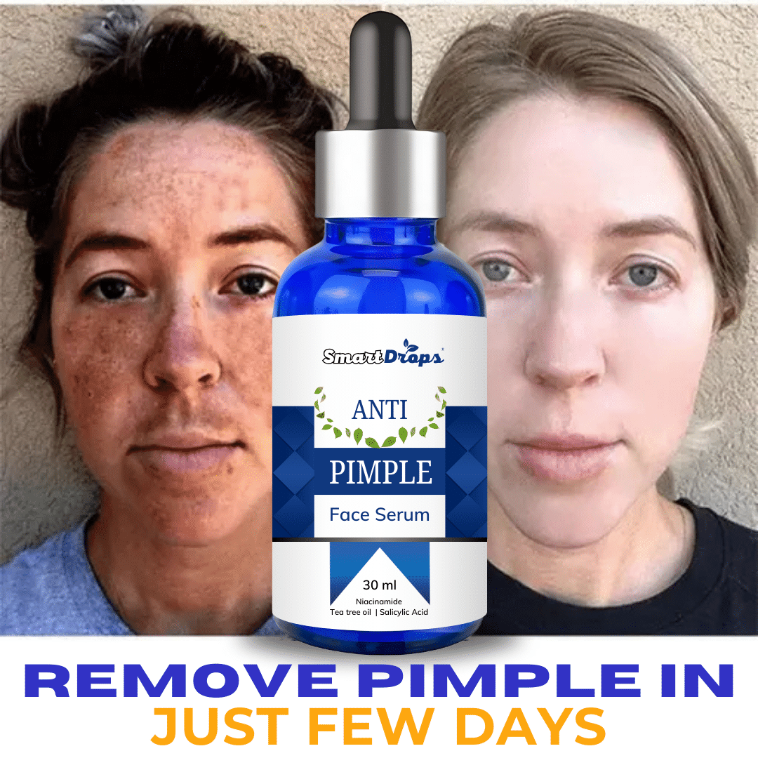     			Smartdrops Face Serum Niacinamide Skin Tightening For Oily Skin ( Pack of 1 )