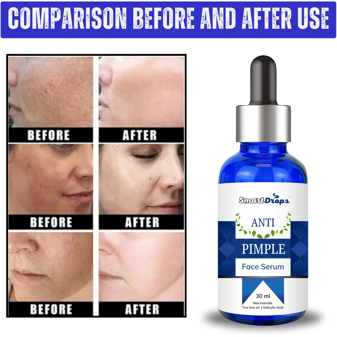 Smartdrops Face Serum Vitamin C Radiant Glow For All Skin Type ( Pack of 1 ) Smartdrops Face Serum Vitamin C Radiant Glow For All Skin Type ( Pack of 1 )