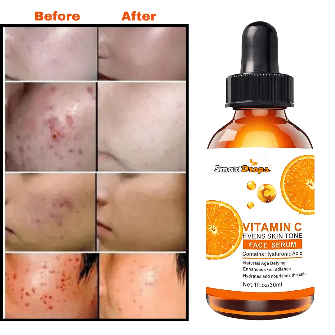 Smartdrops Face Serum Vitamin C Daily Care For All Skin Type ( Pack of 1 ) Smartdrops Face Serum Vitamin C Daily Care For All Skin Type ( Pack of 1 )