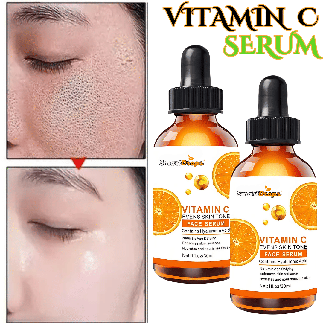 Smartdrops Face Serum Vitamin C Redness Removal For All Skin Type ( Pack of 2 ) Smartdrops Face Serum Vitamin C Redness Removal For All Skin Type ( Pack of 2 )