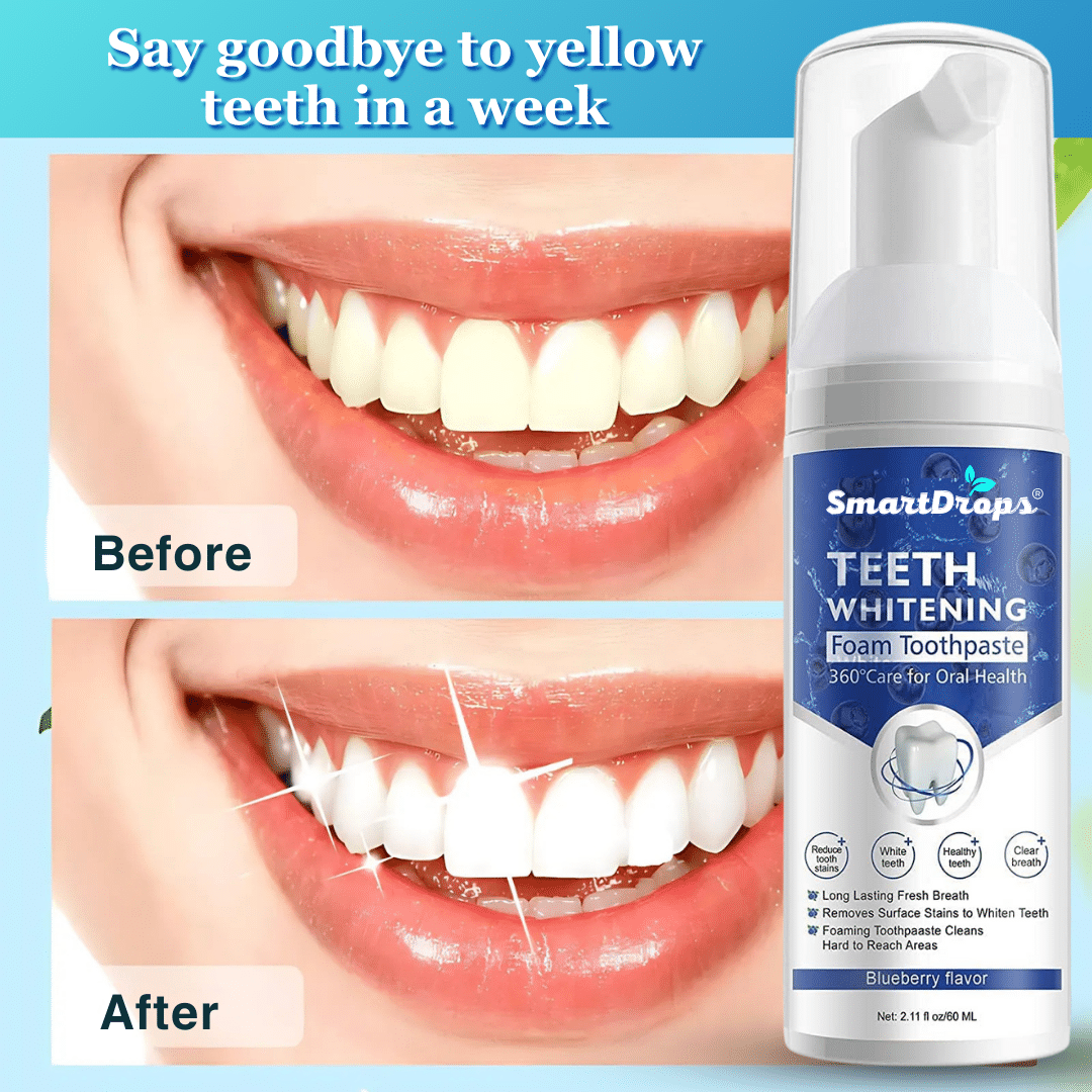 Smartdrops Teeth Whitening Kit 60 Smartdrops Teeth Whitening Kit 60