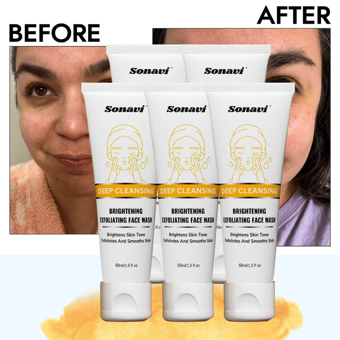 Sonavi - Excess Oil Removal Face Wash For All Skin Type ( Pack of 5 )     			Sonavi - Excess Oil Removal Face Wash For All Skin Type ( Pack of 5 )