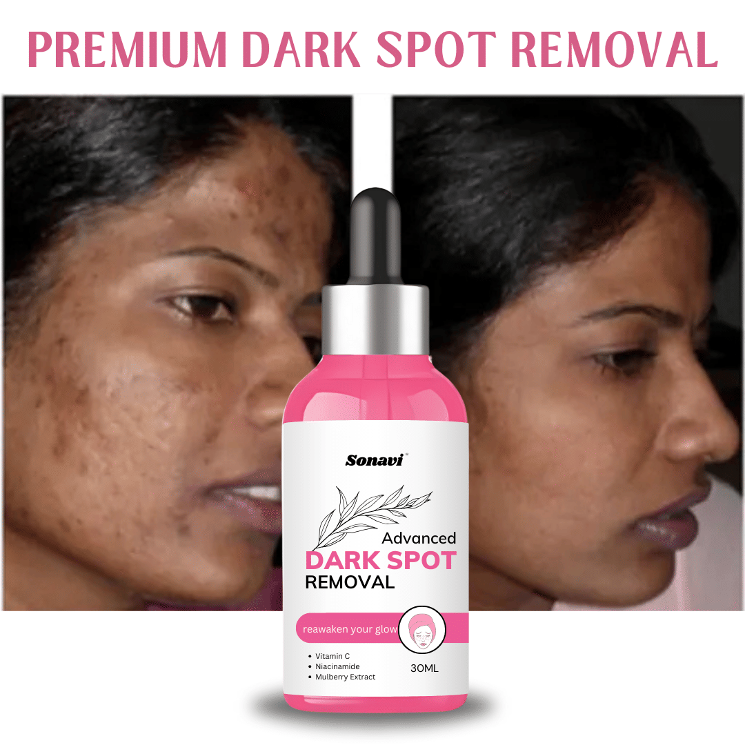 Sonavi Face Serum Niacinamide Moisturizing For All Skin Type ( Pack of 1 )