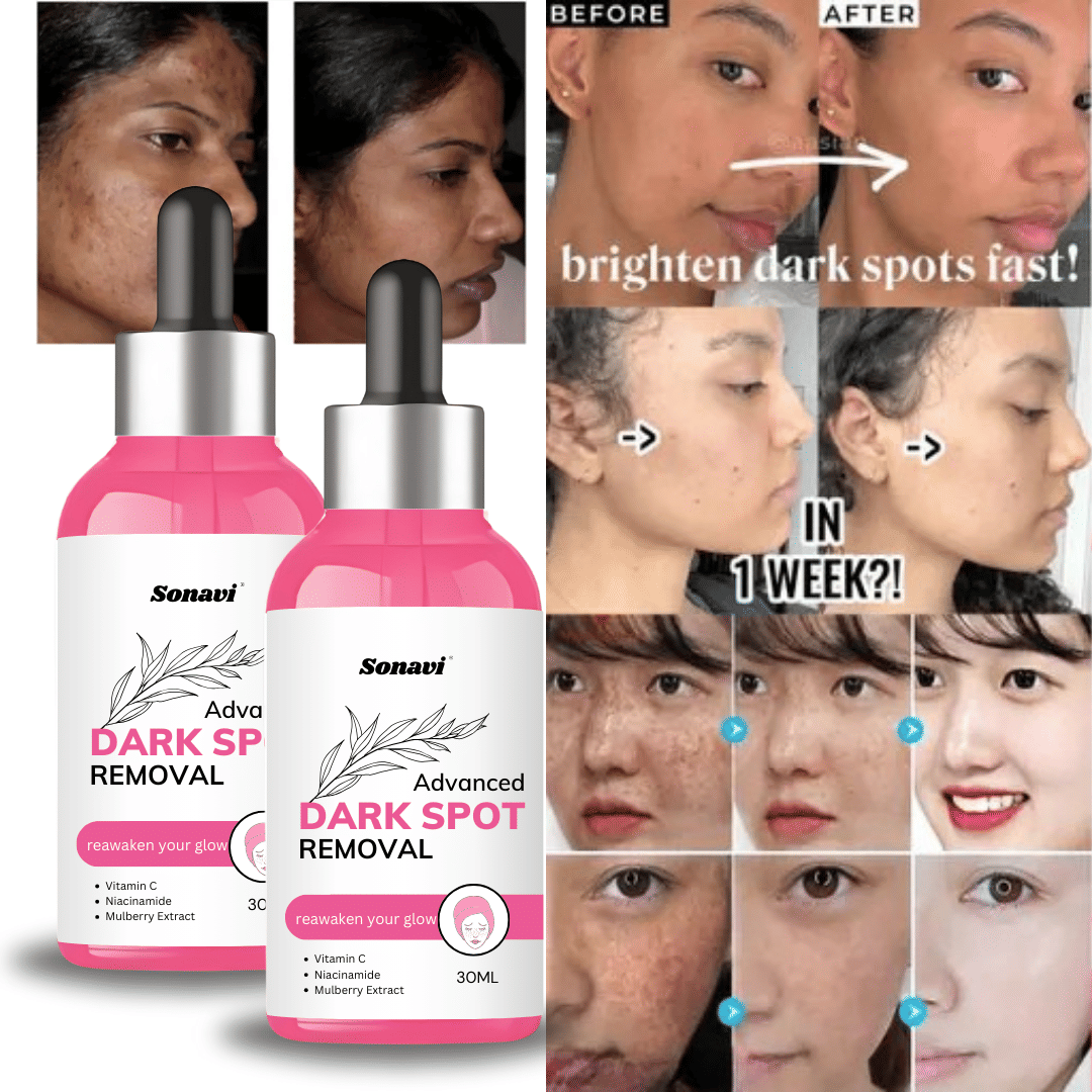 Sonavi Face Serum Niacinamide Spot Removal For All Skin Type ( Pack of 2 )