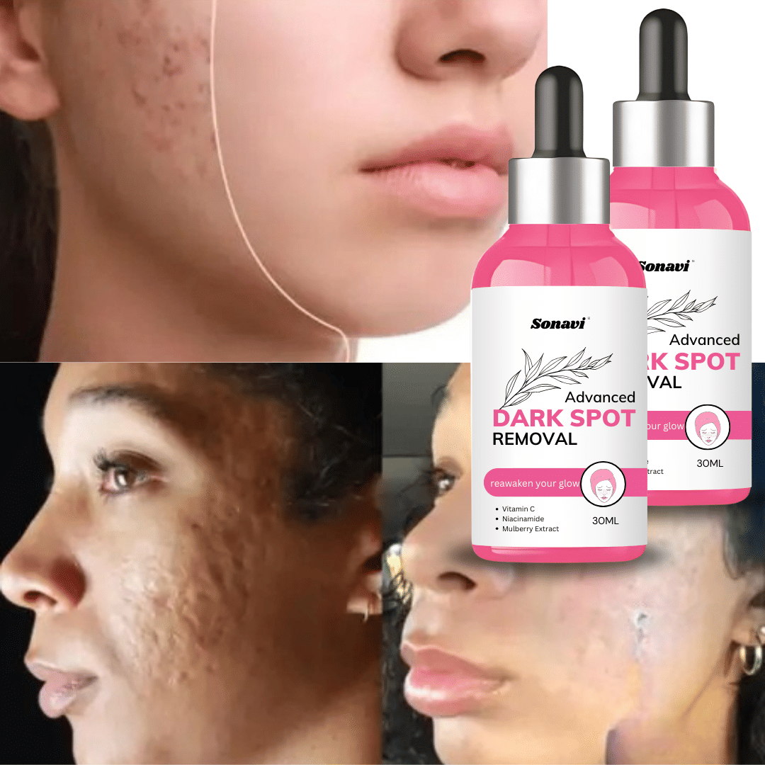     			Sonavi Face Serum Vitamin C Fairness For All Skin Type ( Pack of 2 )