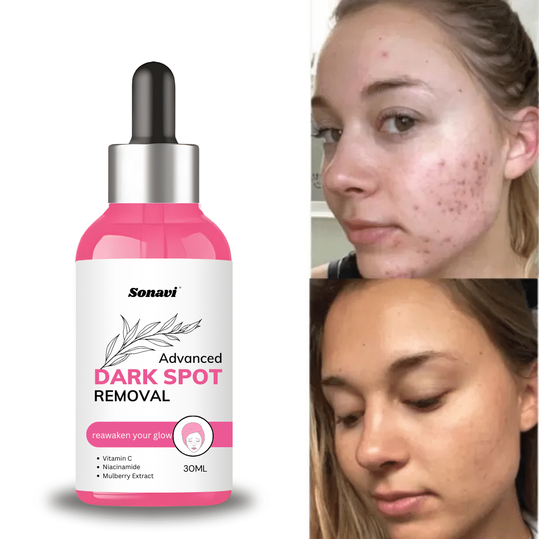 Sonavi Face Serum Vitamin C Pigmentation Reducing For All Skin Type ( Pack of 1 ) Sonavi Face Serum Vitamin C Pigmentation Reducing For All Skin Type ( Pack of 1 )