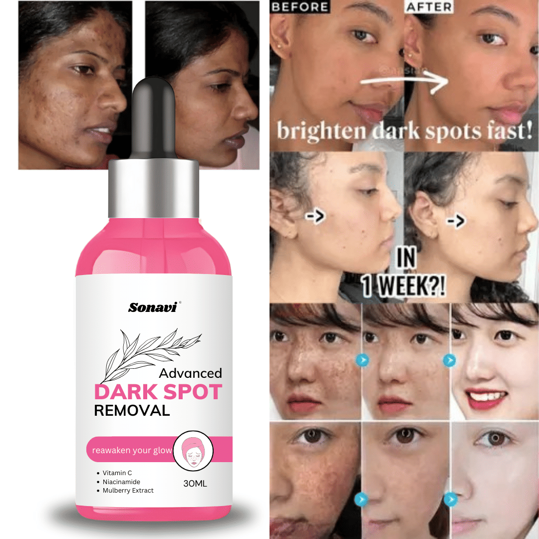 Sonavi Face Serum Vitamin C Maintians Skin Complexion For All Skin Type ( Pack of 1 ) Sonavi Face Serum Vitamin C Maintians Skin Complexion For All Skin Type ( Pack of 1 )