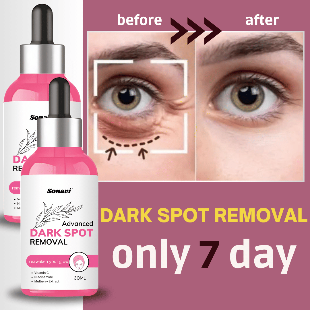 Sonavi Face Serum Vitamin C Radiant Glow For All Skin Type ( Pack of 2 ) Sonavi Face Serum Vitamin C Radiant Glow For All Skin Type ( Pack of 2 )
