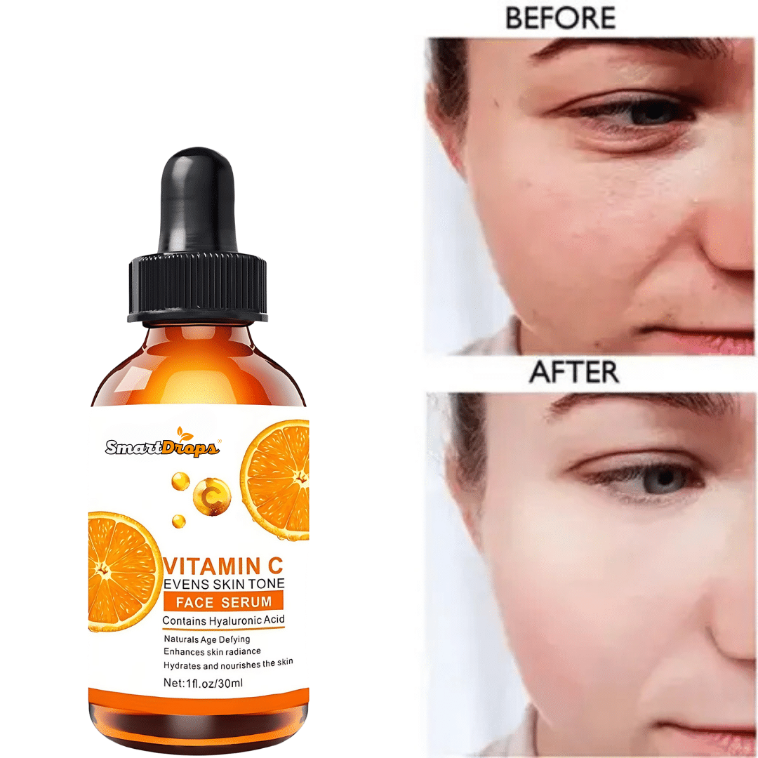     			Smartdrops Face Serum Vitamin C Deep Nourishment For All Skin Type ( Pack of 1 )