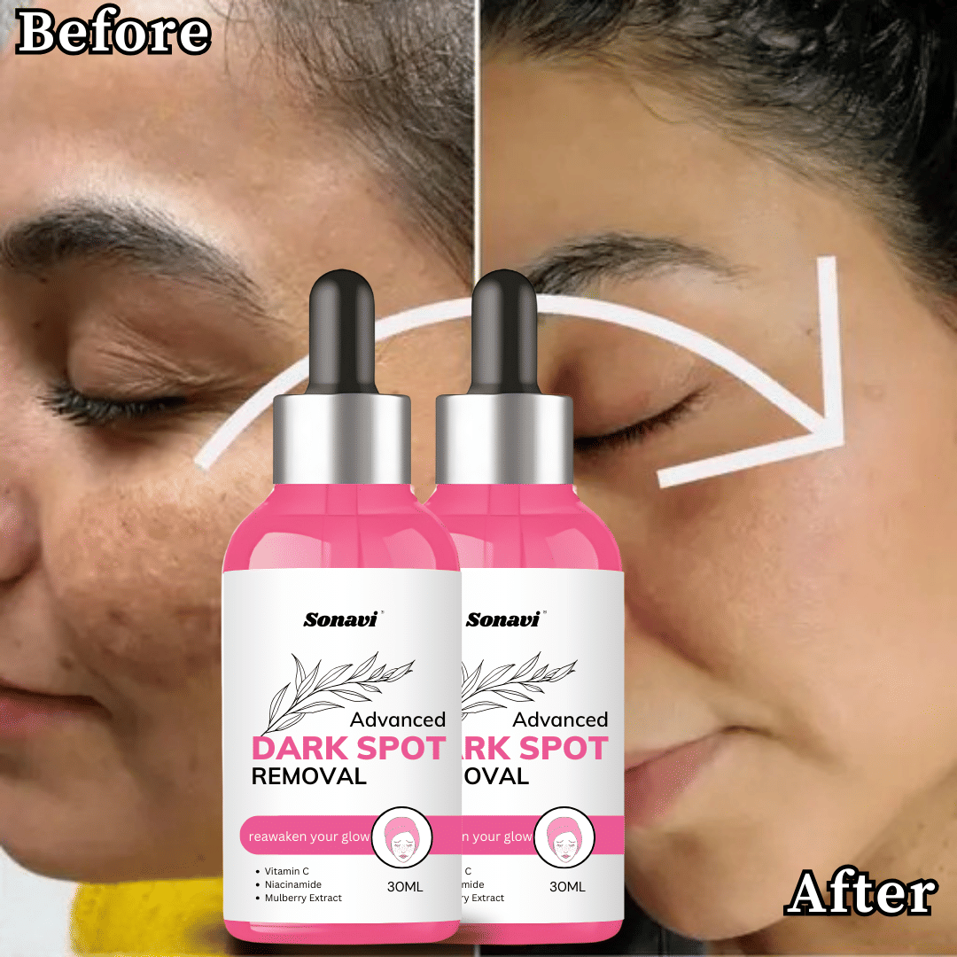     			Sonavi Face Serum Niacinamide Redness Removal For All Skin Type ( Pack of 2 )