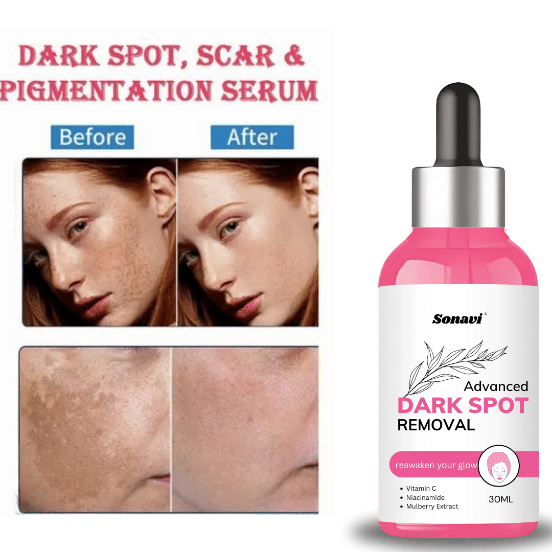 Sonavi Face Serum Niacinamide Retinol Moisturizer For All Skin Type ( Pack of 1 ) Sonavi Face Serum Niacinamide Retinol Moisturizer For All Skin Type ( Pack of 1 )