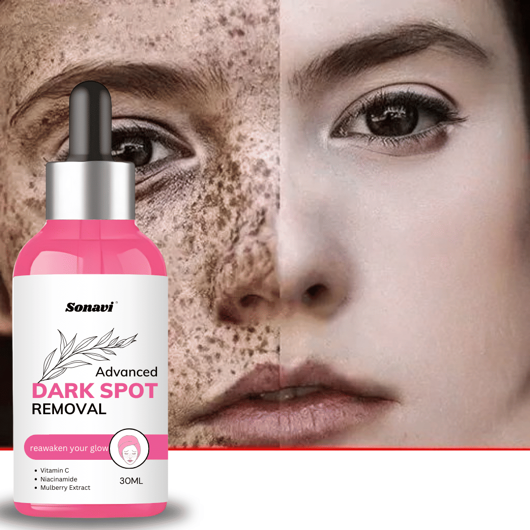 Sonavi Face Serum Niacinamide Spot Removal For All Skin Type ( Pack of 1 )