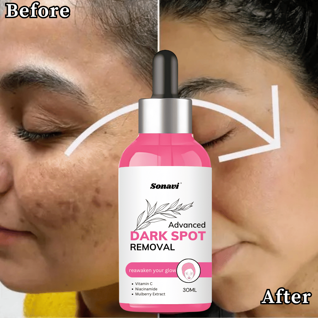 Sonavi Face Serum Vitamin C Deep Nourishment For All Skin Type ( Pack of 1 ) Sonavi Face Serum Vitamin C Deep Nourishment For All Skin Type ( Pack of 1 )