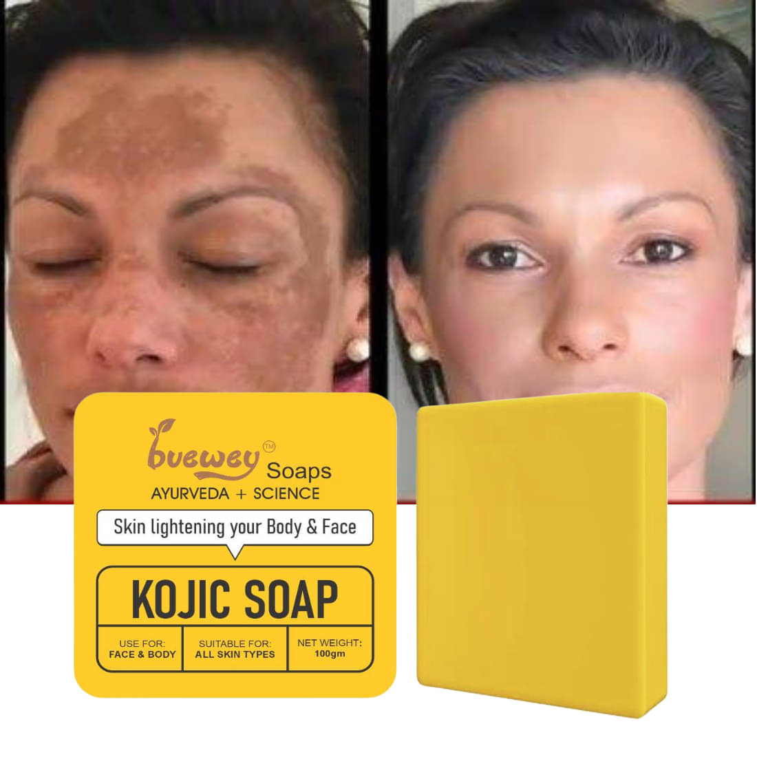 BUEWEY Beauty Kogic Soap Often used as a treatment Soap for All Skin Type ( Pack of 1 ) BUEWEY Beauty Kogic Soap Often used as a treatment Soap for All Skin Type ( Pack of 1 )